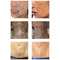Kobiety Body Art Animowane urządzenie do usuwania tatuażu brwi 12000 obr./min